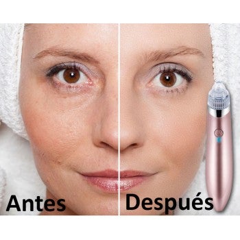 EXTRACTOR DE ESPINILLAS