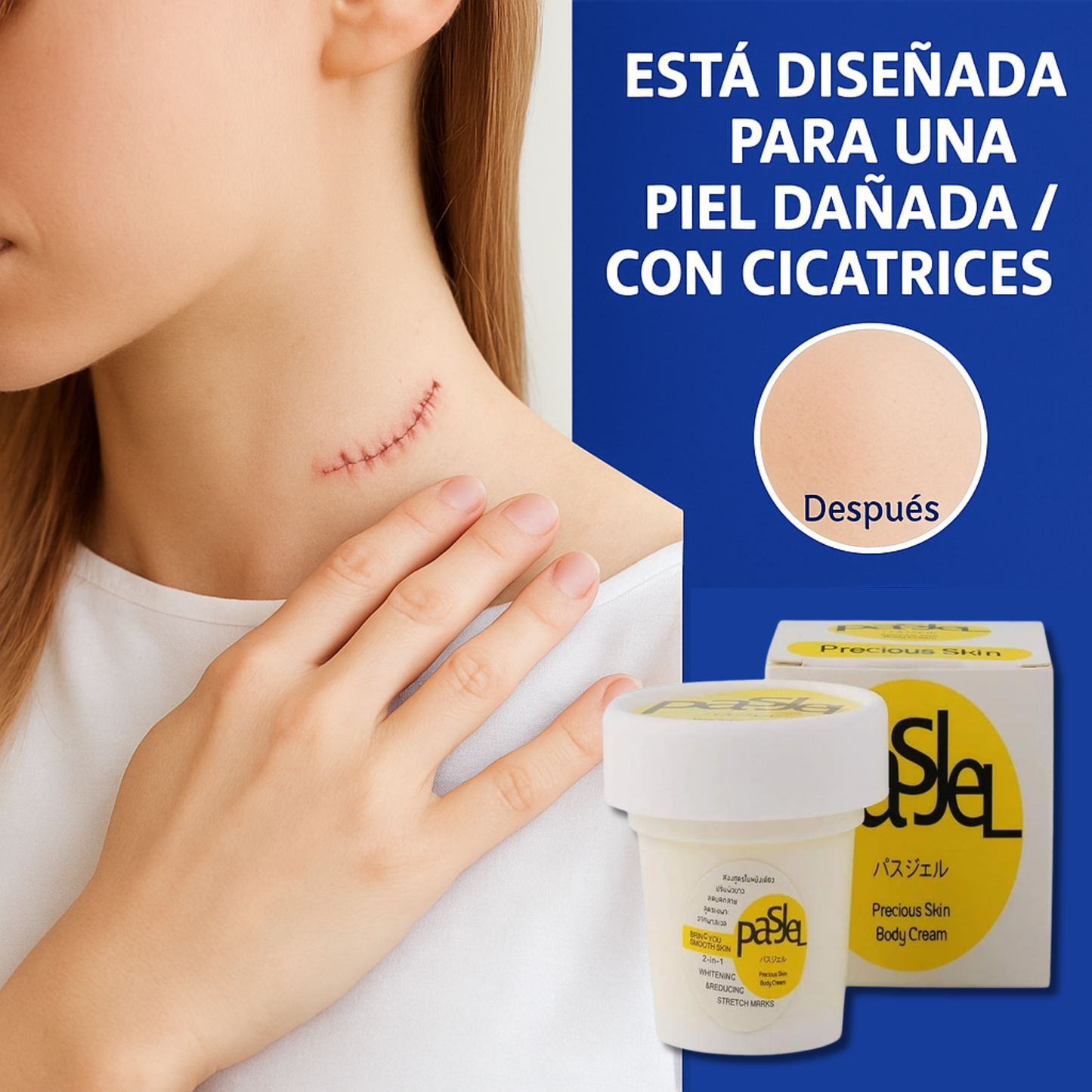 CREMA ELIMINA CICATRICES