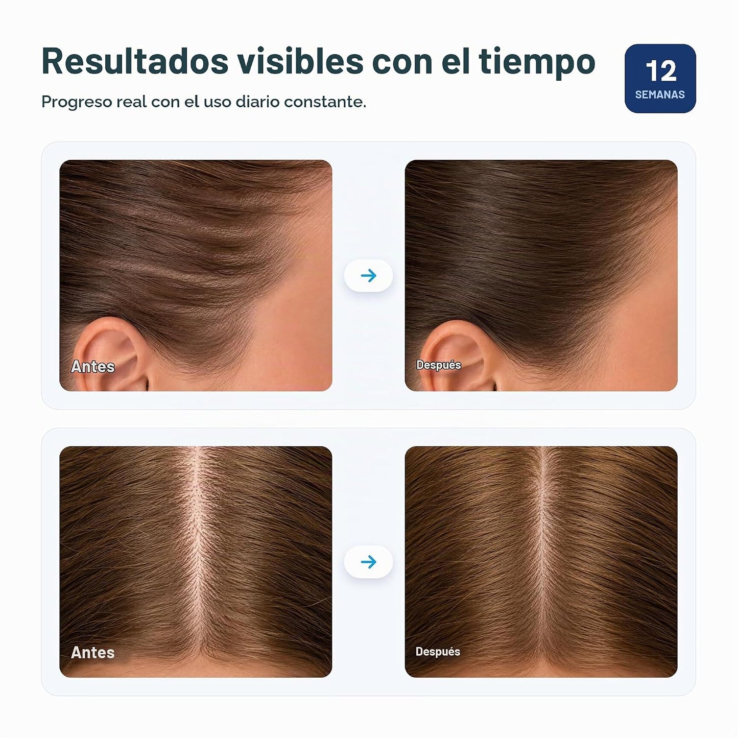 BodyWise Roll on - Suero para el crecimiento del cabello