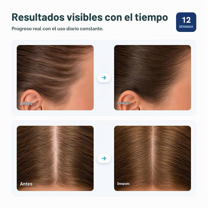 BodyWise Roll on - Suero para el crecimiento del cabello