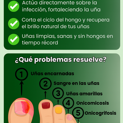 Eliminador de Hongos de Uñas – Uñas más sanas y fuertes en pocos días