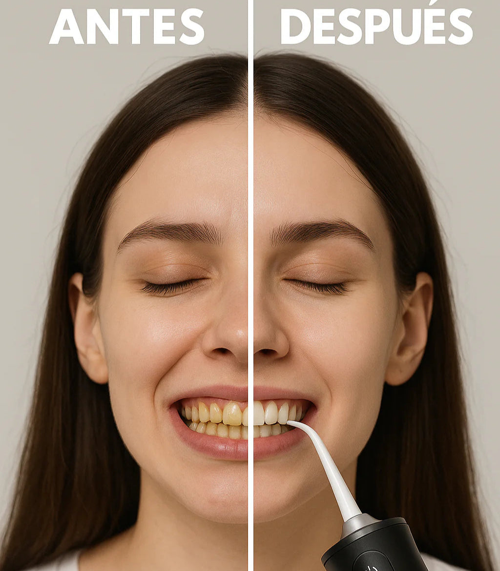 IRRIGADOR ORAL PORTATIL