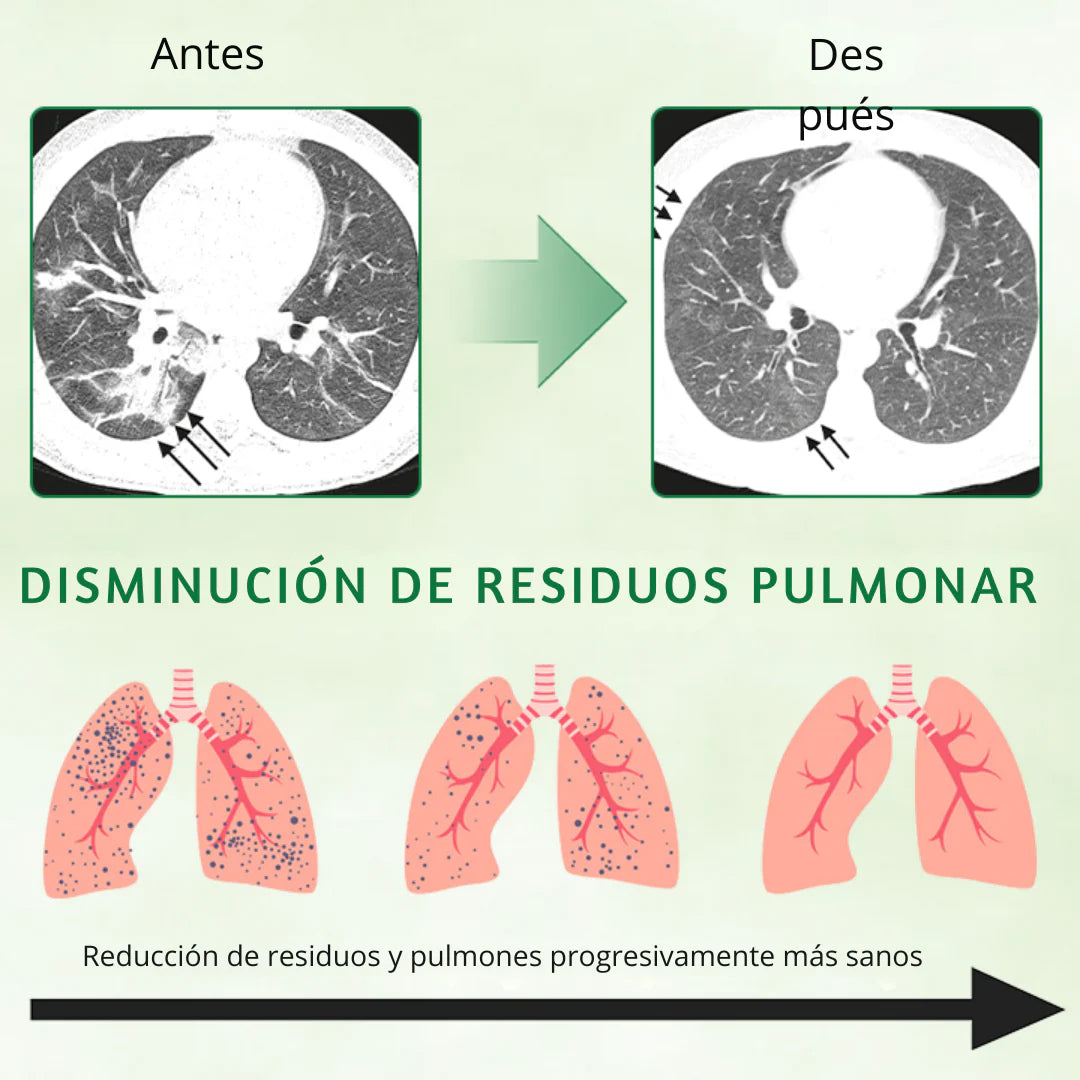 GOTAS SPRAY LIMPIA PULMON MULLEIN