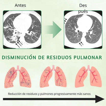 GOTAS SPRAY LIMPIA PULMON MULLEIN