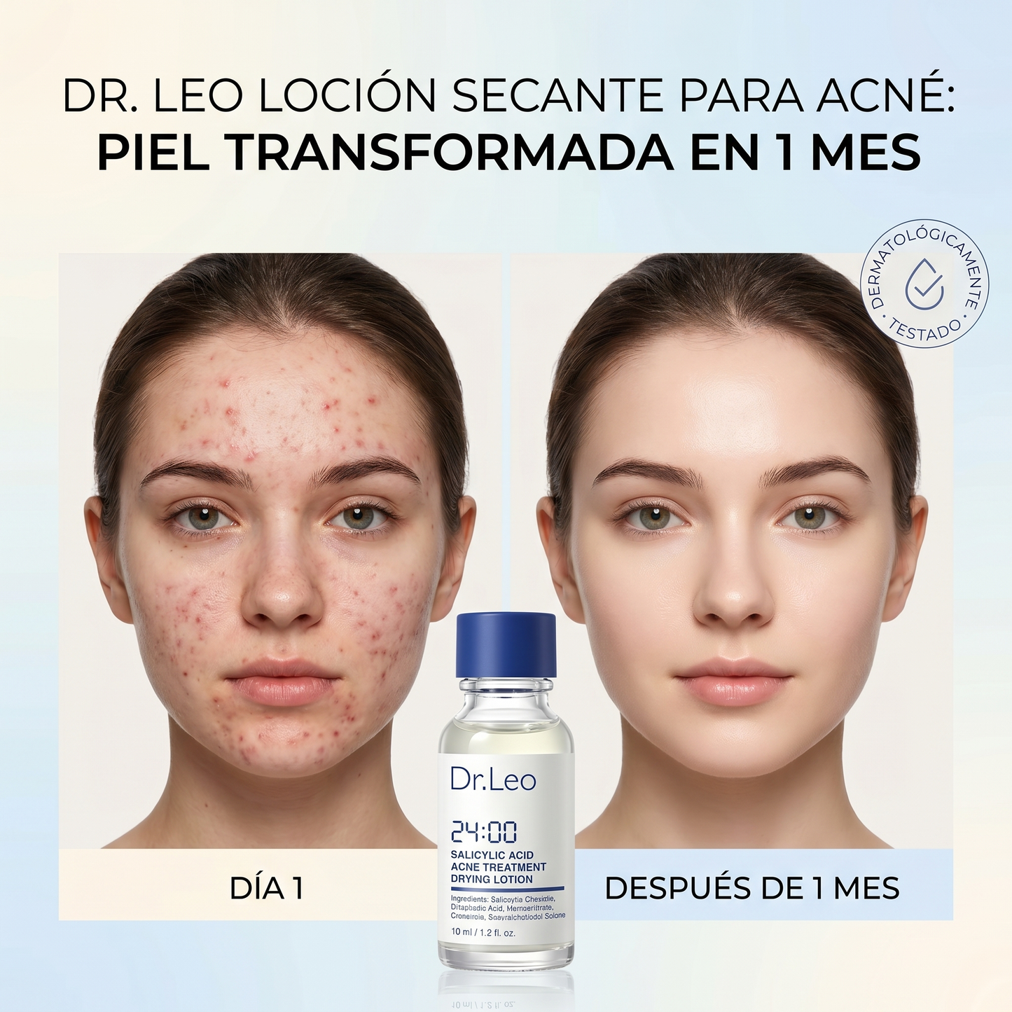Loción Secante para Acné Dr. Leo